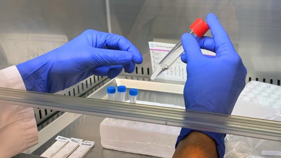 630 nuevos casos de coronavirus en Aragón durante la última jornada