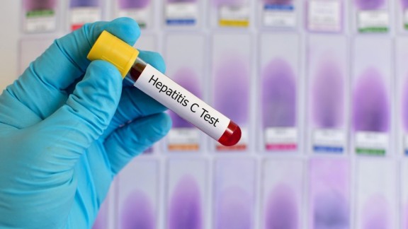 La OMS advierte de un brote de hepatitis 