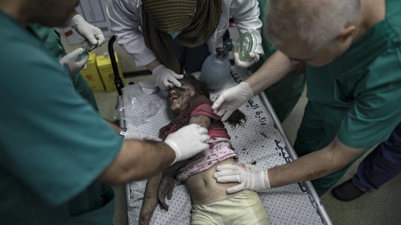 La OMS denuncia que Israel ha atacado 250 hospitales, centros de salud o ambulancias palestinas